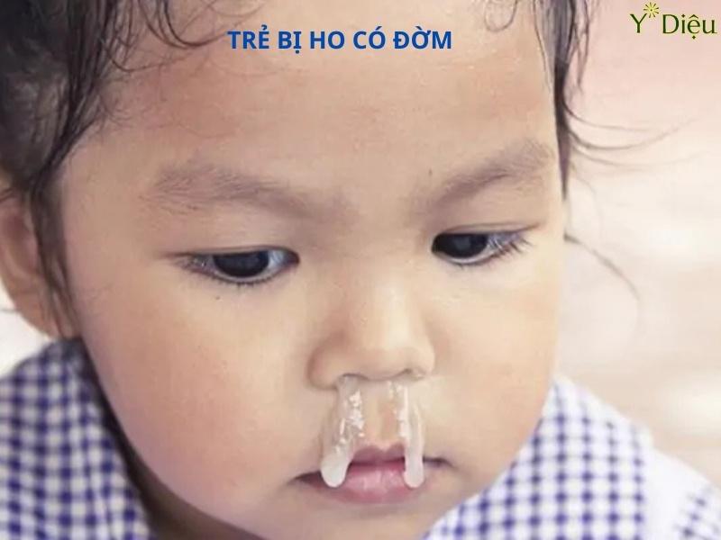 Đờm là 1 chất nhầy có tác dụng như 1 hàng rào sinh học bảo vệ hệ hô hấp